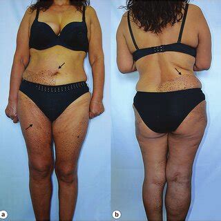 5 Hot Sexy Micaela Di Stefano Bikini Pics