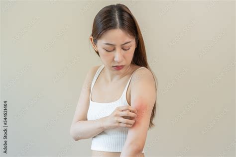 Dermatology Asian Young Woman Girl Allergy Allergic Reaction From