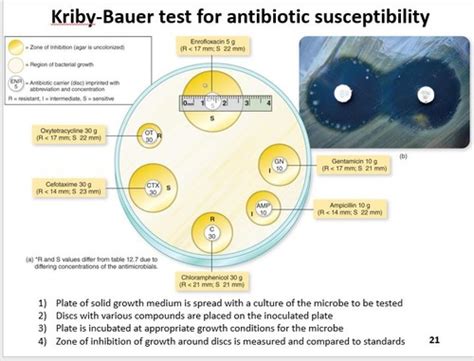 Microbio Chapter Lectures Flashcards Quizlet