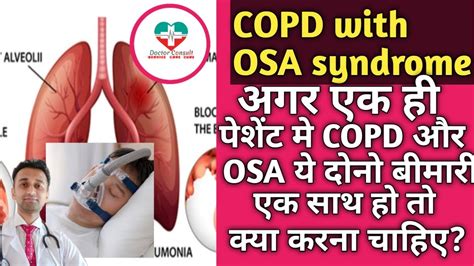 Copd With Osa Overlap Syndrome Copd Osa