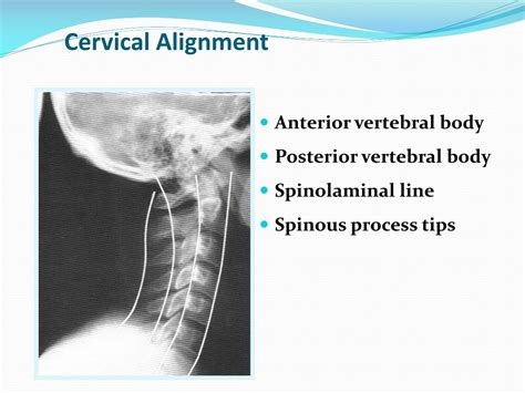PPT - Spine Anatomy and Back Muscles PowerPoint Presentation, free