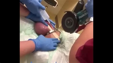 Así le sacaron la tuerca XVIDEOS