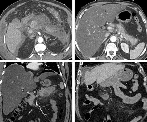 CT Quick Guides - CTisus.com CT Scanning