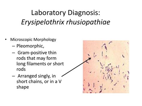 Erysipelothrix On Chocolate Agar