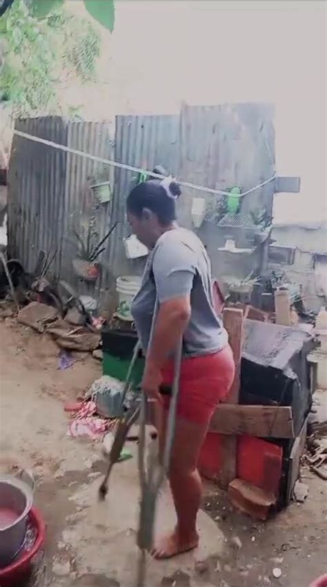 Amputee Mature Lak ThisVid