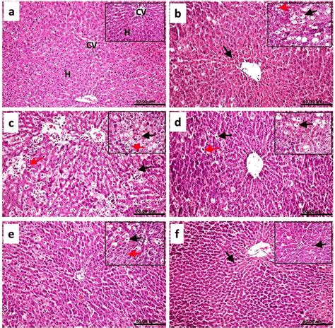 Liver Of Rat A From Normal Group Showing The Normal Histological