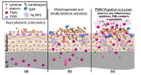 An Updated Working Model Of The Immunopathogenesis Of C Albicans