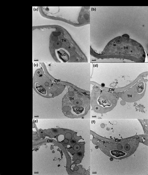 Transmission Electron Micrographs Of Chloroplast In Mesophyll Cells Of Download Scientific