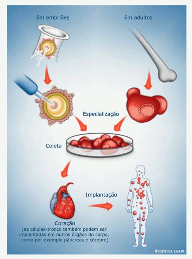 Células Tronco Clínica Saadi Cirurgia Cardiovascular