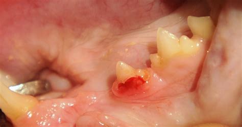 Feline Tooth Resorption Lesions Perth Cat Hospital