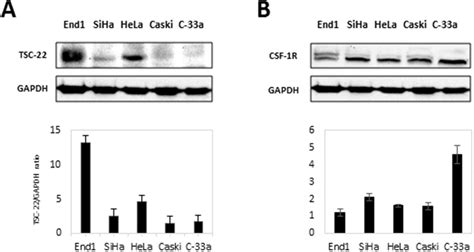 Protein Levels Of Csf 1r And Tsc 22 In Cervical Cancer Cells A Total Download Scientific