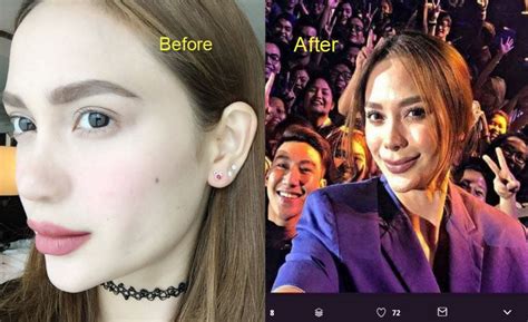 Arci Munoz Hounded By Plastic Surgery Rumors Anew Starmometer