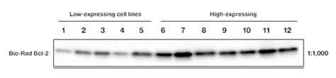 Western Blot Optimization Enhance Detection Quantification Of Low