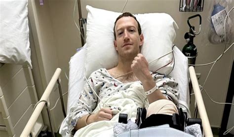 Mark Zuckerberg undergoes knee surgery