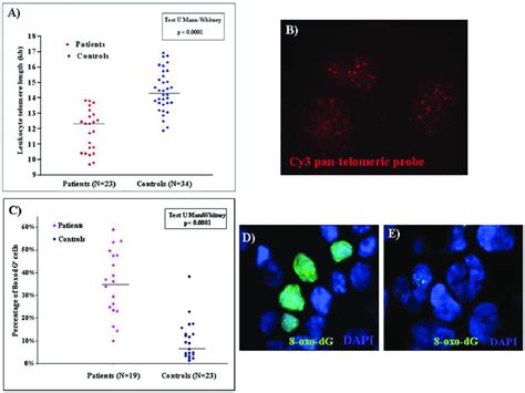 Telomere Length And Oxidative DNA Damage In Lymphocytes From Each