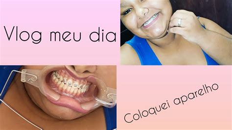 Vlog Dias Comigo Coloquei Aparelho Casada Aos Youtube