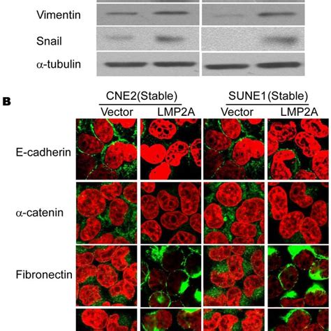 The Overexpression Of LMP2A In NPC Cell Lines Induces EMT Like Cellular