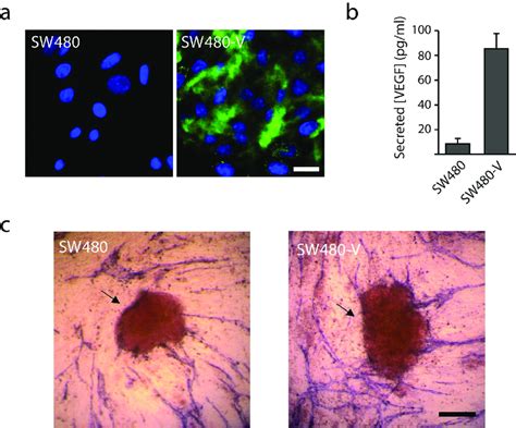 Vessel Growth Is Directed Towards The Colon Cancer Spheroids Secreting Download Scientific