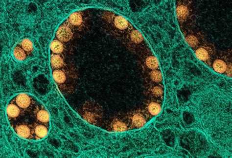 Discovery Of Novel Antibody That Targets Shared Epitope On SARS CoV 2