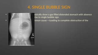 abdominal xray radiology finalpptx pptx