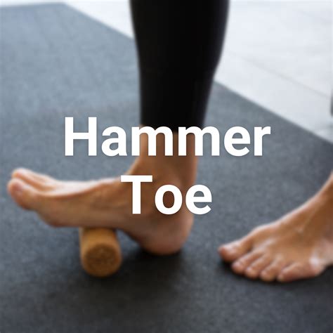 Hammer Toe – The Rehab Mechanics