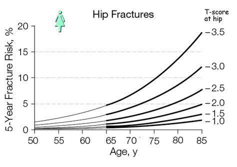 Bmd And Fracture Risk