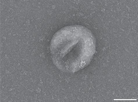 Characterization And Mirna Composition Of Adsc Exos A Electron