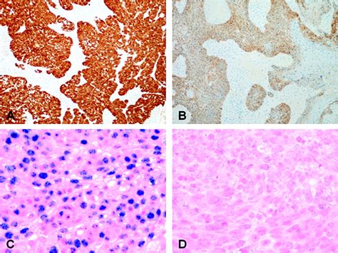 Evaluation Of Human Papillomavirus Testing For Squamous Cell Carcinoma