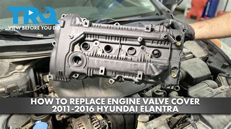 How To Replace Engine Valve Cover Hyundai Elantra A Auto