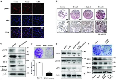 Il 32γ Inhibits Constitutive Activation Of Stat5 Signaling In Cd133