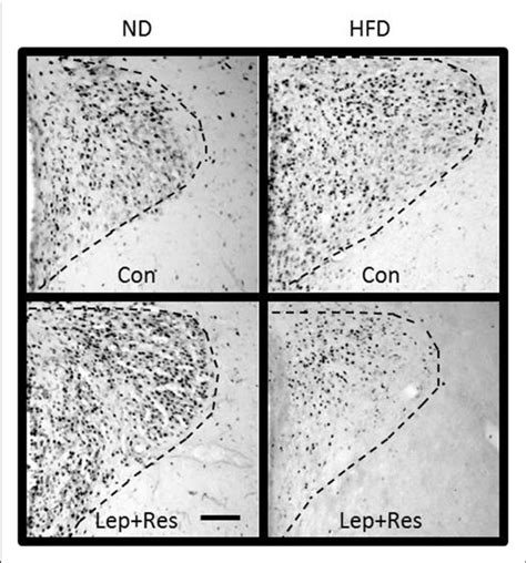 Photomicrographs Showing Fos Positive Cell Nuclei In The