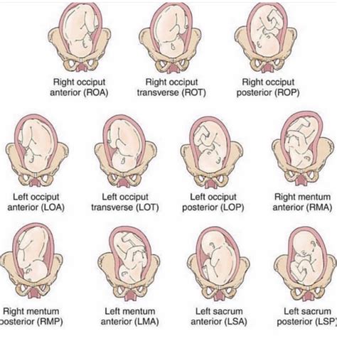 Maternal And OB Flashcards Quizlet