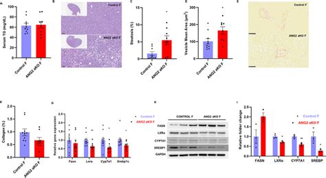 Hfd Feeding Induced Liver Steatosis Without Fibrosis In Ang2 Ako Female