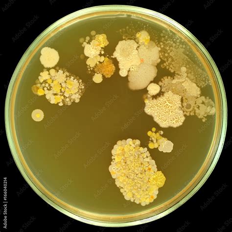 Colorful Bacterial Colonies On Sterile Agar In Petri Plate Inoculation