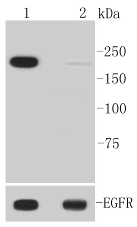 Phospho Egfr Tyr Rabbit Anti Human Clone F Bioss L