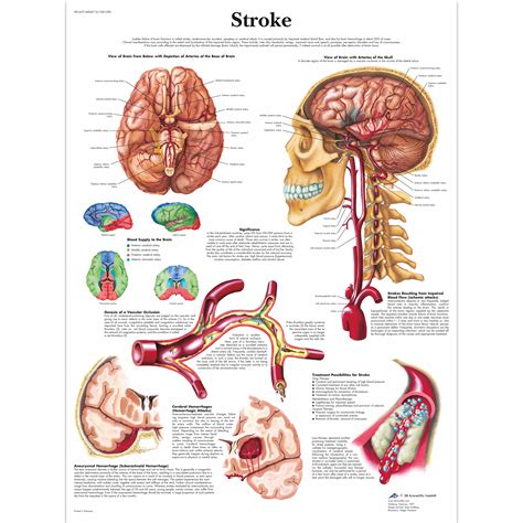 Van Stroke Scale Chart