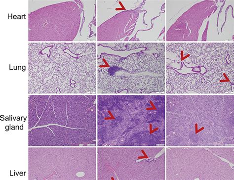 Soluble Ctla Mutants Ameliorate Immune Related Adverse Events But