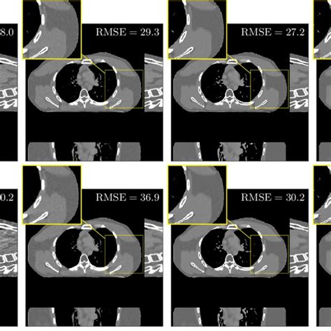 Pdf Sparse View X Ray Ct Reconstruction Using L Prior With Learned