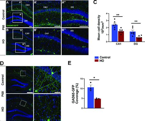 Perinatal Oxidative Stress Causes Long Term Alteration In Interneuron