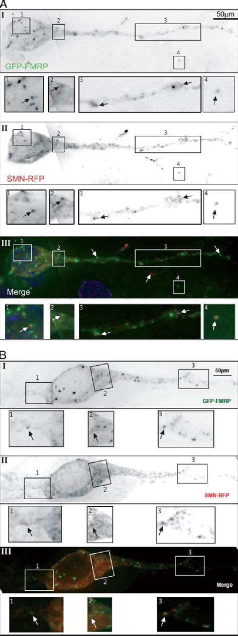 Figure 2 From In Vitro And In Cellulo Evidences For Association Of The