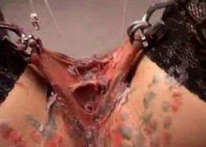 Forumophilia PORN FORUM Needle Pain BDSM Extreme Tit Torture