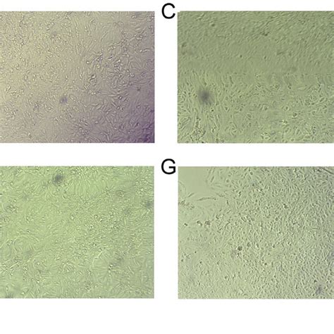 Advanced Marfey S Analysis Of Compound By Lc Ms Selective Ion