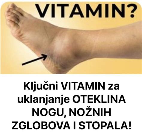 Ključni VITAMIN Za Uklanjanje OTEKLINA NOGU NOŽNIH ZGLOBOVA I STOPALA