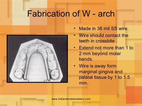 Image Result For W Arch Appliance In Orthodontics Orthodontics