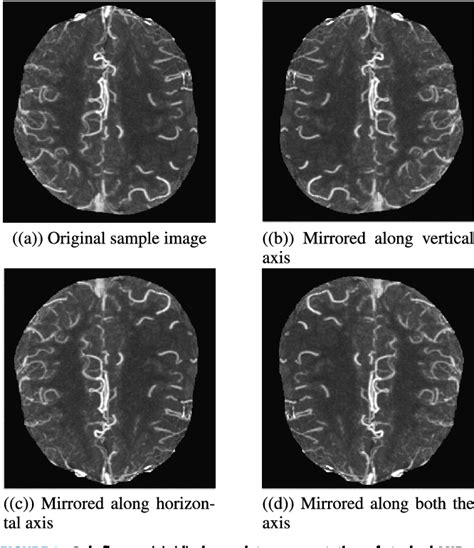 Figure From Multilevel Multimodal Framework For Automatic Collateral