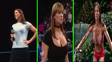 Stephanie Mcmahon Before And After Surgery