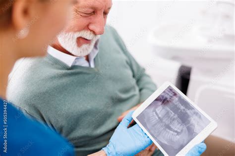 Dentist showing jaw x-ray to senior male patient Stock Photo | Adobe Stock