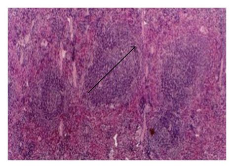 Enlargement Of Spleen Lymphoid Nodules Due To V2o5 Exposure A Normal Download Scientific