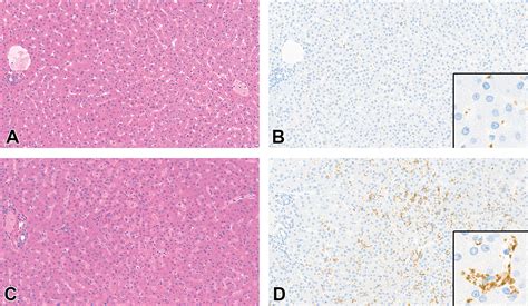 Liver Histology Sinusoids