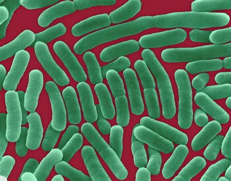 Salmonella Typhi Photograph By Dennis Kunkel Microscopyscience Photo Library Pixels